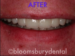 bloomsbury dental website photos.026