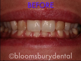 bloomsbury dental website photos.037